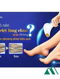 Chú Nhỏ Không Có Lông Chân FULL